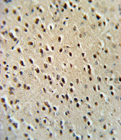Polyclonal Rabbit anti-Human HPRT1 / HPRT Antibody (aa150-178, IHC, WB)