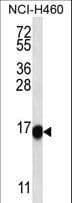 TMEM257 / CXorf1 Antibody (aa62-90)