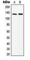 ABL1 / c-ABL Antibody (N-Terminus)