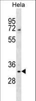Polyclonal Rabbit anti-Human WDR4 Antibody (aa146-173, WB)