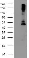 LPL / Lipoprotein Lipase Antibody (clone OTI3A10)