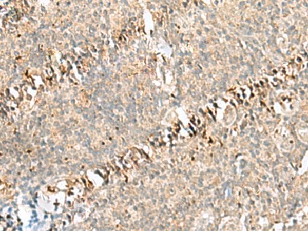 Polyclonal Rabbit anti-Human RABGGTA Antibody (IHC)