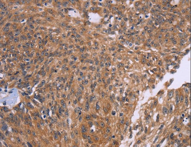 CTNNBL1 / NAP Antibody