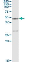 Monoclonal Mouse anti-Human CPA1 / Carboxypeptidase A Antibody (clone 3F11, WB)