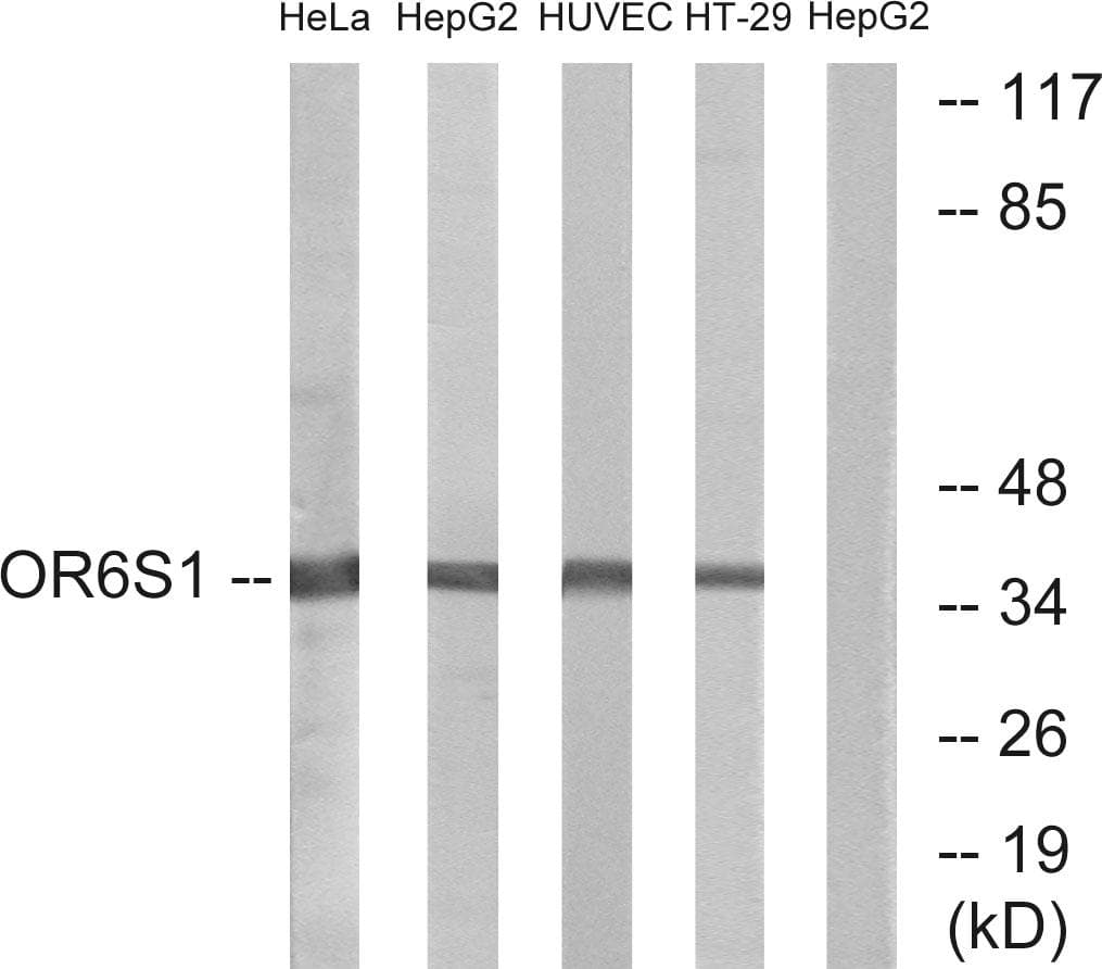 Polyclonal Rabbit anti-Human OR6S1 Antibody (WB)