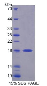Human SNAPIN Protein (Recombinant His-T7)