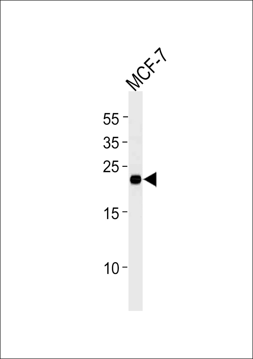 MGMT Antibody (clone 888CT22.2.4)