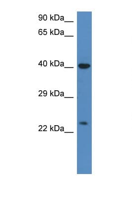 PRSS1 / Trypsin Antibody (C-Terminus, HRP)