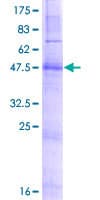 Human ZDHHC21 Protein (Recombinant GST)