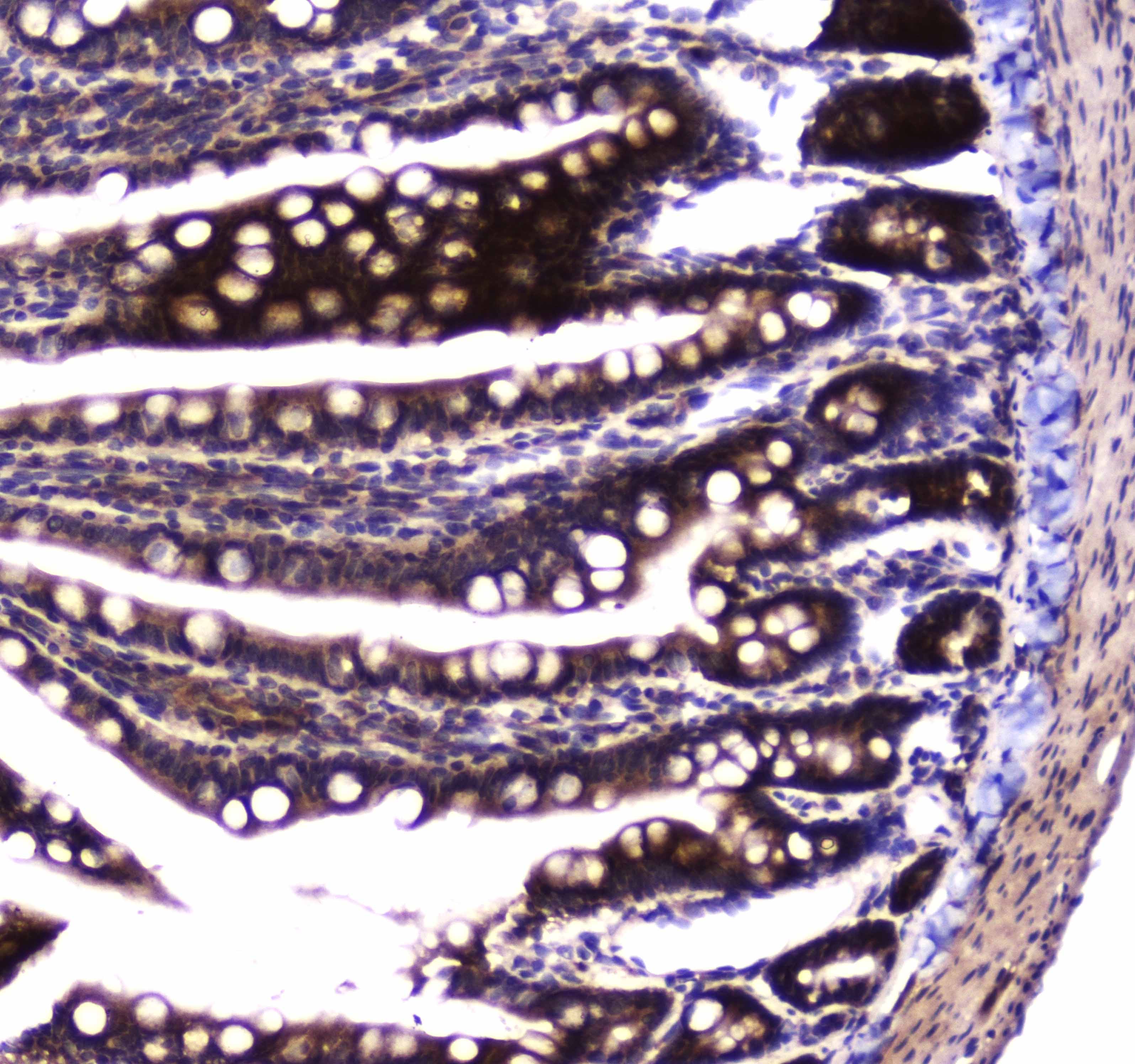 SDHB Antibody