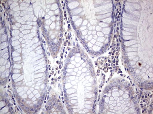 Monoclonal Mouse anti-Human PKM2 Antibody (clone 1F12, IHC, WB)