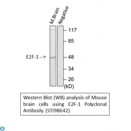 Polyclonal Rabbit anti-Human E2F1 Antibody (WB)
