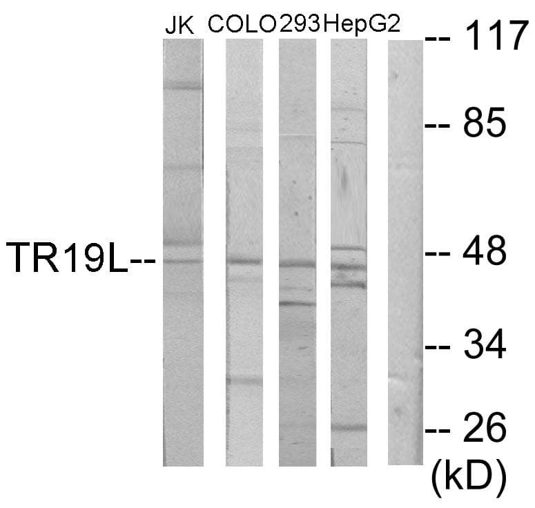 Polyclonal Rabbit anti-Human TNFRSF19L / RELT Antibody (WB)