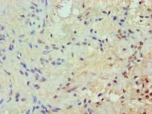 Polyclonal Rabbit anti-Human JUNB / JUN-B Antibody (aa1-240, IHC)