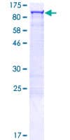 Human CALCOCO1 / CoCoa Protein (Recombinant GST)