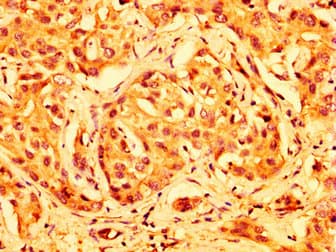 ABCG5 Antibody