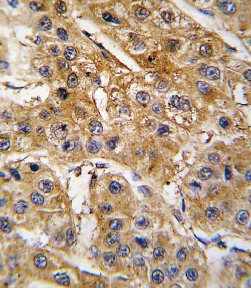 AGT / Angiotensinogen Antibody (aa37-65)