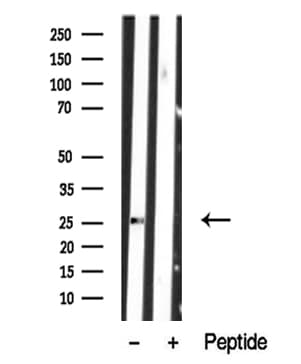 LAT2 / NTAL Antibody