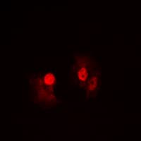 NFKB1 / NF-Kappa-B Antibody (C-Terminus)