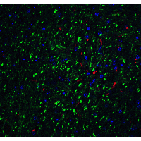 IHC-plus™ LMX1B Antibody