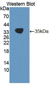 CDK20 / CCRK Antibody