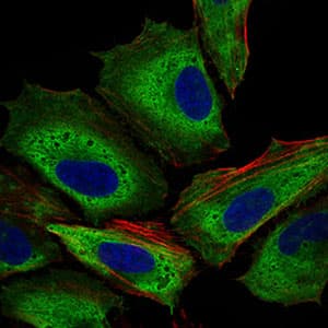IL3RA / CD123 Antibody (aa200-305, clone 8E11C5)