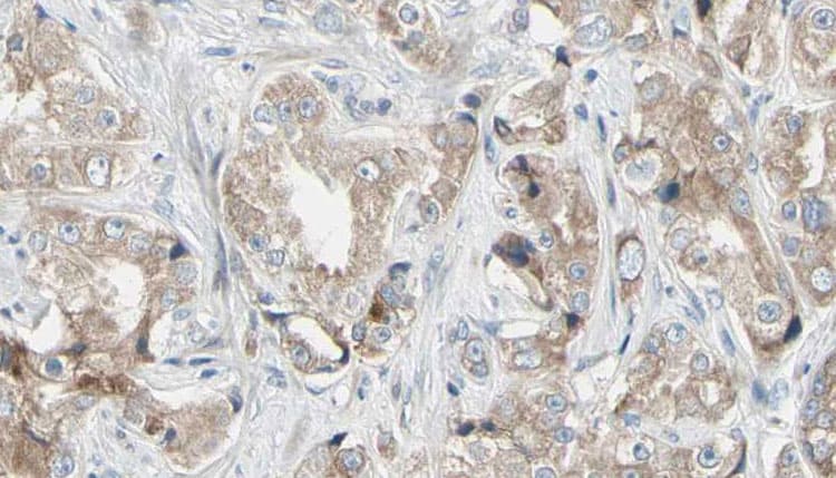 RPL24 / Ribosomal Protein L24 Antibody (aa90-120)