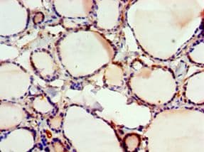 Polyclonal Rabbit anti-Human FUBP3 Antibody (aa65-260, IHC, WB)