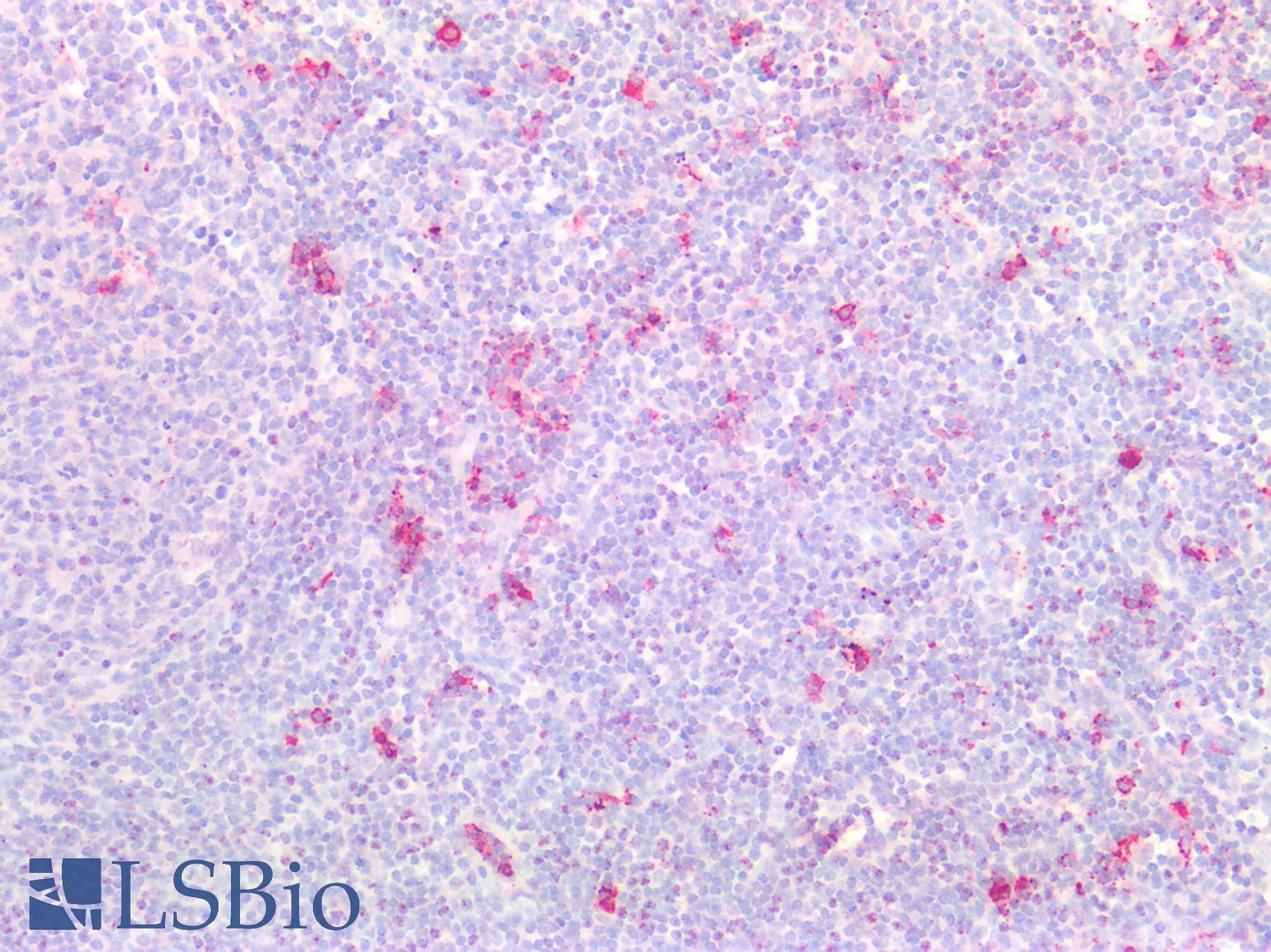 PathPlus™ Monoclonal Mouse anti-Human TMIGD2 Antibody (clone 7A10, IHC, IF)