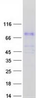Human BBS7 Protein (Recombinant Myc-DDK (Flag))