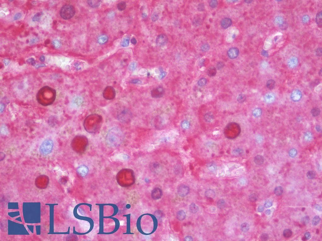 IHC-plus™ Monoclonal Mouse anti-Human SERPINA1 / Alpha 1 Antitrypsin Antibody (clone 9A1, IHC, WB)