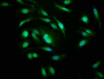 PSMD10 / Gankyrin Antibody (aa1-226)