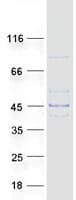 Human LDHAL6B Protein (Recombinant Myc-DDK (Flag))