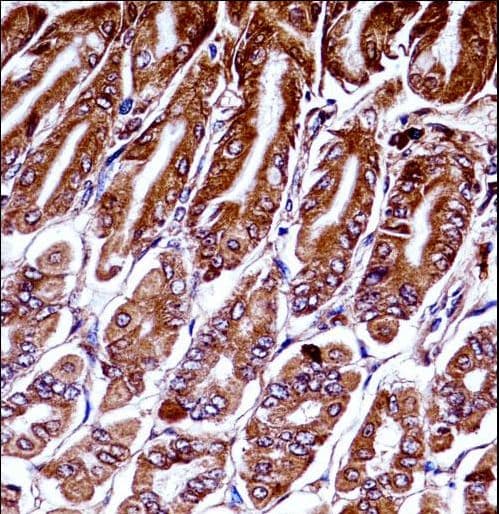Polyclonal Rabbit anti-Mouse MAP3K7 / TAK1 Antibody (aa131-160, IHC, WB)
