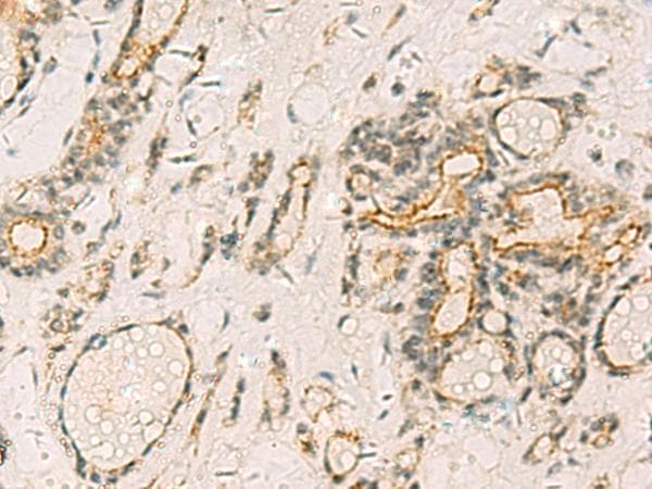 Polyclonal Rabbit anti-Human HORMAD2 Antibody (IHC)
