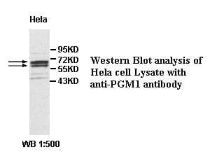 PGM1 / Phosphoglucomutase 1 Antibody (aa228-478)