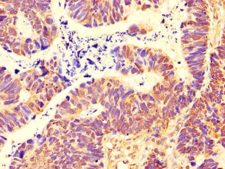 SH3BP5 / SAB Antibody