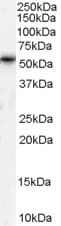 IHC-plus™ TPTE Antibody (aa371-383)