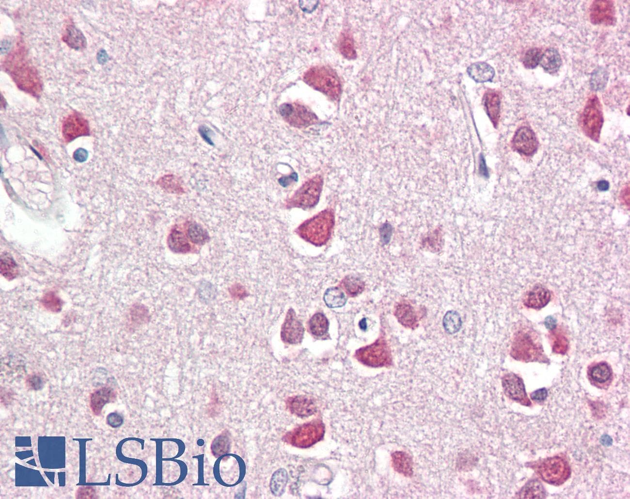 IHC-plus™ DBX2 Antibody