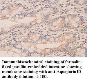 AQP10 / Aquaporin 10 Antibody (C-Terminus)