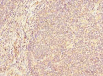 Polyclonal Rabbit anti-Human MCF2L / DBS Antibody (IHC)