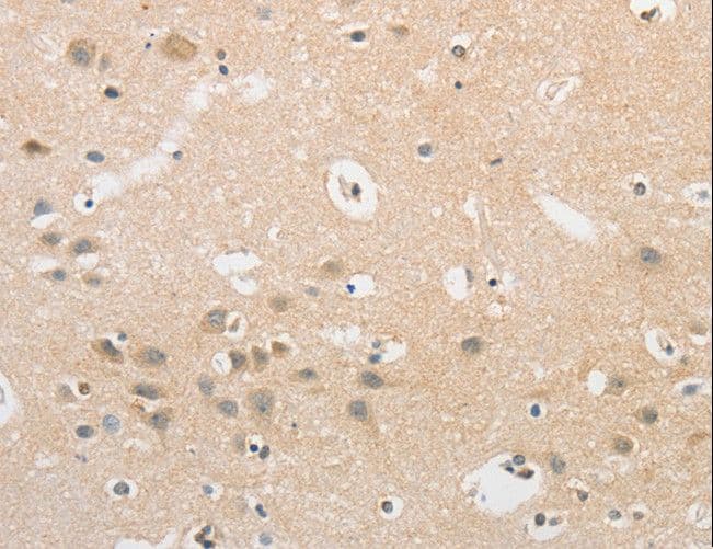 APLF / PALF Antibody