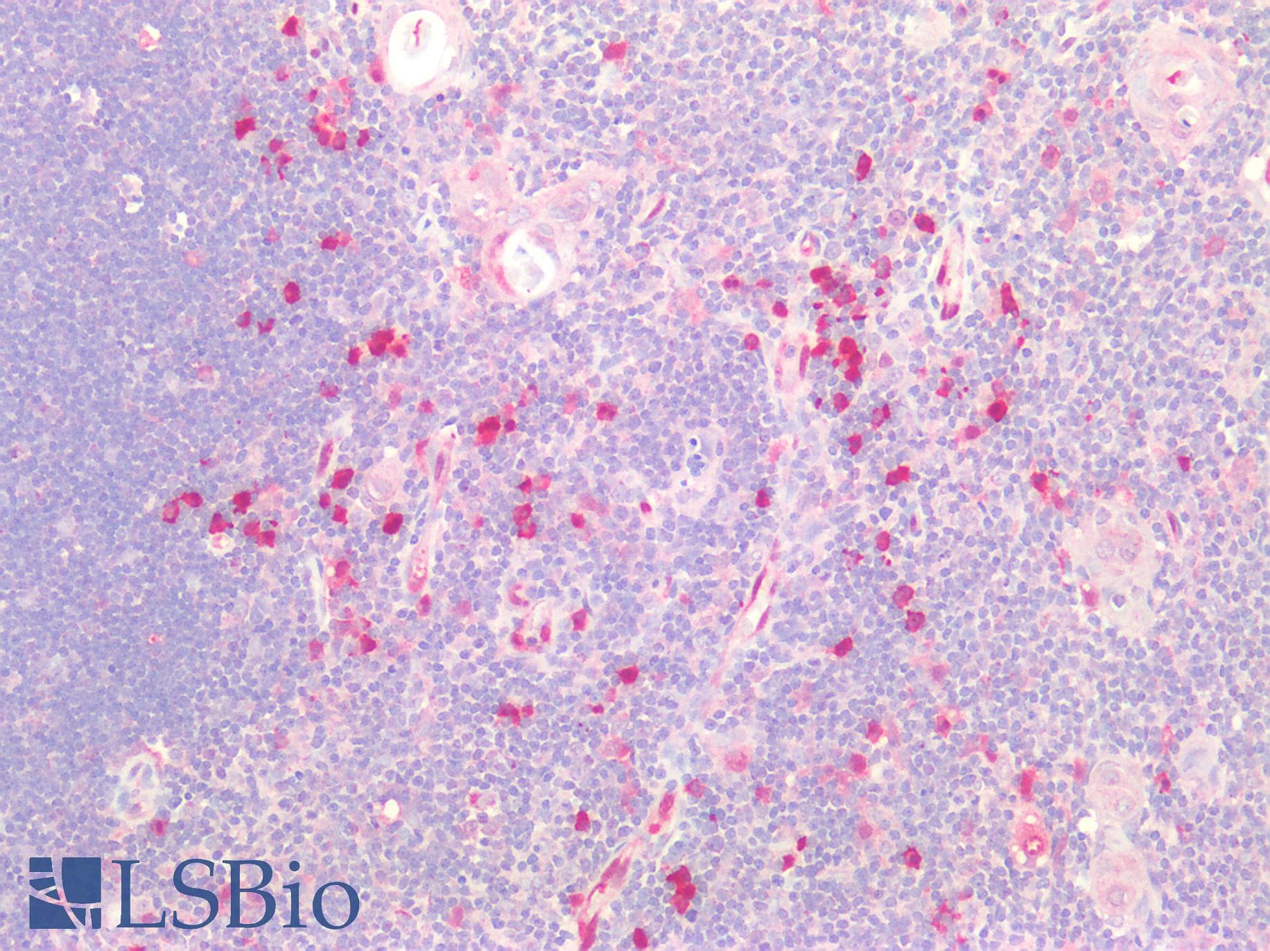 PathPlus™ CDA / Cytidine Deaminase Antibody