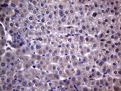 NDUFAF5 Antibody (clone OTI6A9)