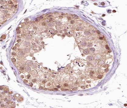 FGFR1OP / FOP Antibody