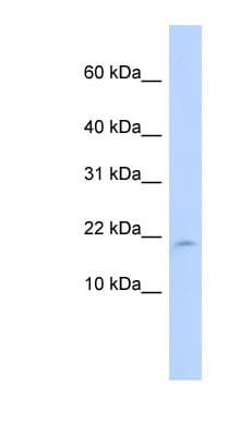 LAIR2 / CD306 Antibody (N-Terminus)