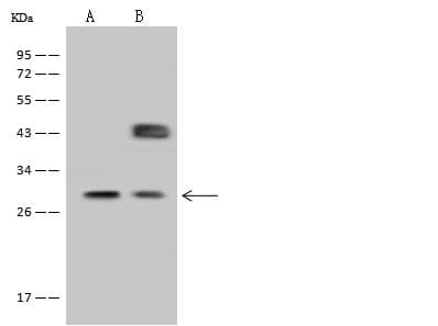 FBP / FOLR2 Antibody (Preservative Free)