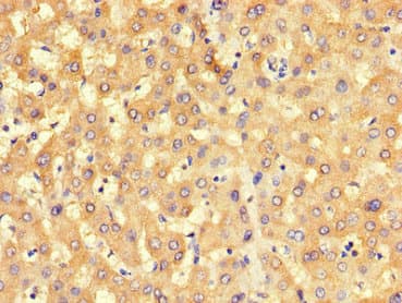 BHMT2 Antibody