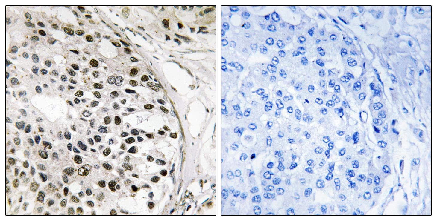 MKNK1 / MNK1 Antibody