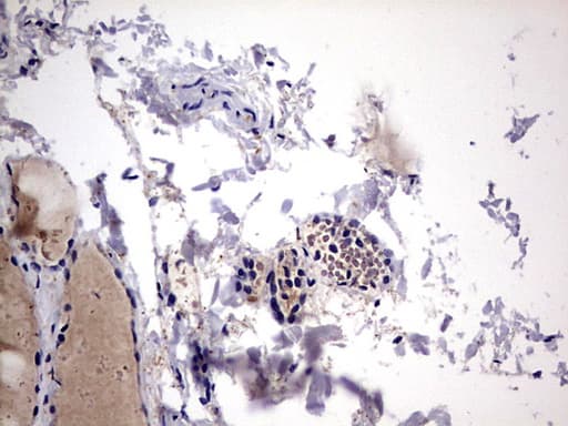 LGALS3 / Galectin 3 Antibody (clone OTI1C7)